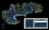 Human FFPE intestinal biopsy stained on CellScape XR