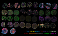 TMA consisting of 12 neoplastic and non-neoplastic human FFPE tissue samples from different organs of origin, with colon, placenta, tonsil, kidney, skin, liver, prostate cancer, brain, breast cancer, lung cancer, melanoma, and testis, was stained with 208 antibodies plus DNA stain
