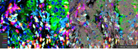 Same-cell subcellular multiomic imaging of the human whole transcriptome (WTX) and 64+ proteins from breast cancer tissue