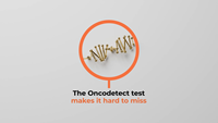 Introducing the Oncodetect test from Exact Sciences Corp.